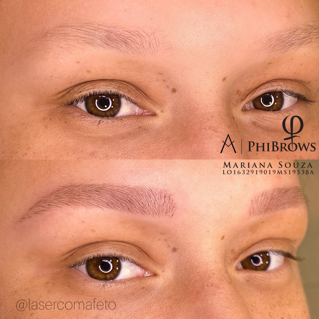 Antes e depois de Nano Pigmentação fio a fio · Mariana Souza